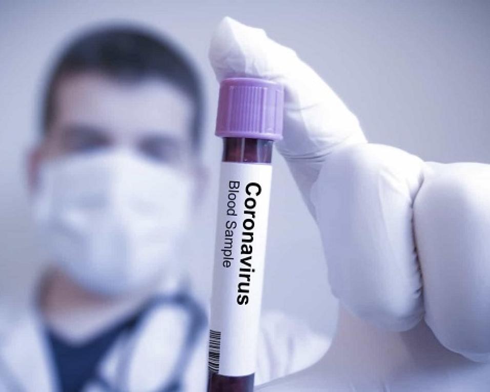 CIRA à margem dos testes Covid nas creches da região. CIRA à margem dos testes Covid nas creches da região.